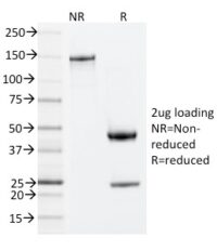 Data from SDS-PAGE analysis of Anti-ZAP70 antibody (Clone ZAP70/2035). Reducing lane (R) shows heavy and light chain fragments. NR lane shows intact antibody with expected MW of approximately 150 kDa. The data are consistent with a high purity, intact mAb.